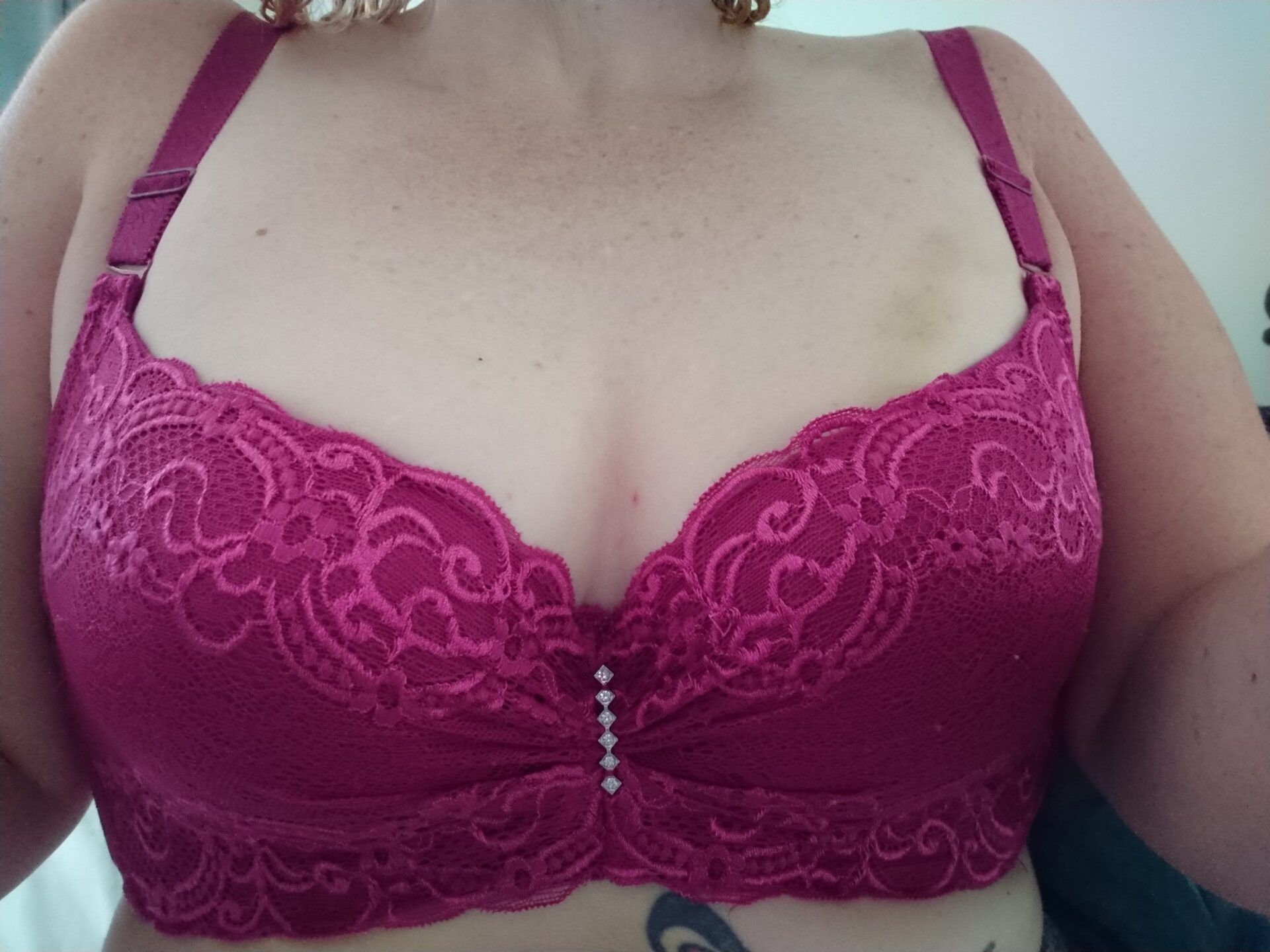 Lady wearing a cerise lacy bra, Framed by the fabric are traces of finger print bruises on her left breast