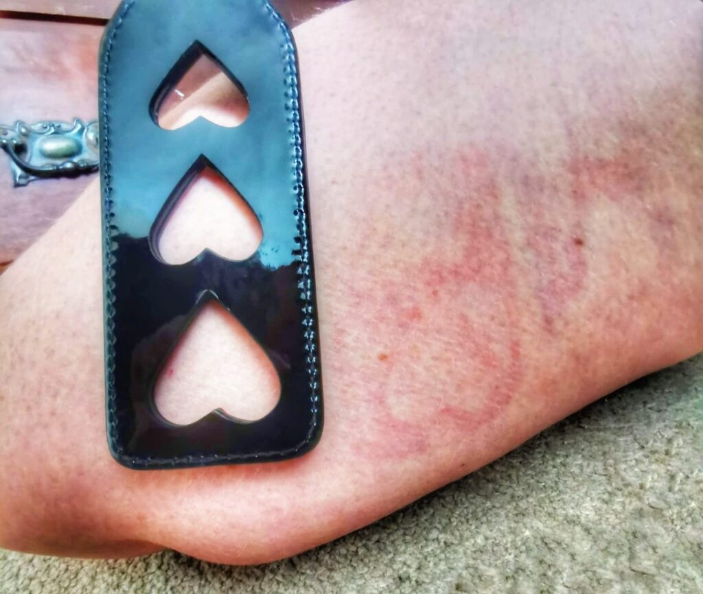 Love under all circumstances header shows a naked thigh with a shiny paddle with heart shapes cut out of it resting on the thigh. Alongside that is the red heart shaped imprint on the skin.